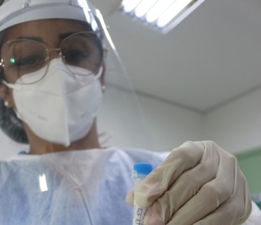 Coronavírus: Itajaí amplia oferta de teste antígeno para população