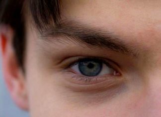 Estrabismo: tipos, sinais e características podem resultar em doenças mais graves, dizem médicos